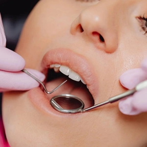 5 Dental Care Tips to Improve Oral Hygiene