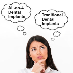 All-On-4 Vs. Traditional Dental Implants