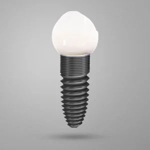 Dental Implants is the Best and Safest Method | Midland, TX